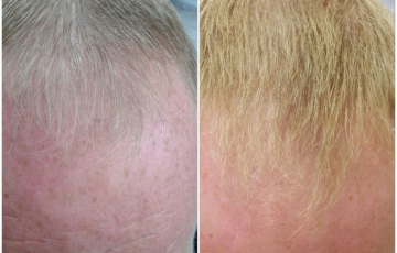 Comparison of a client before and after the Stop & Grow application